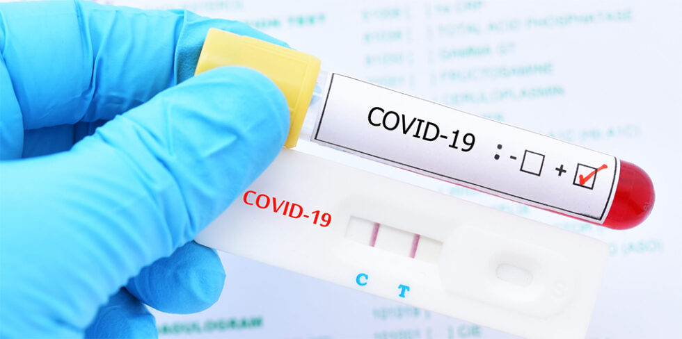 medicare-to-start-paying-for-at-home-covid-tests